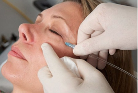 carboxytherapie kliniekdokterfrodo