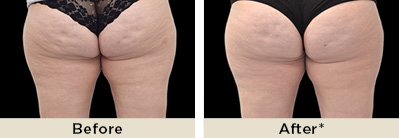 rr unison before after4